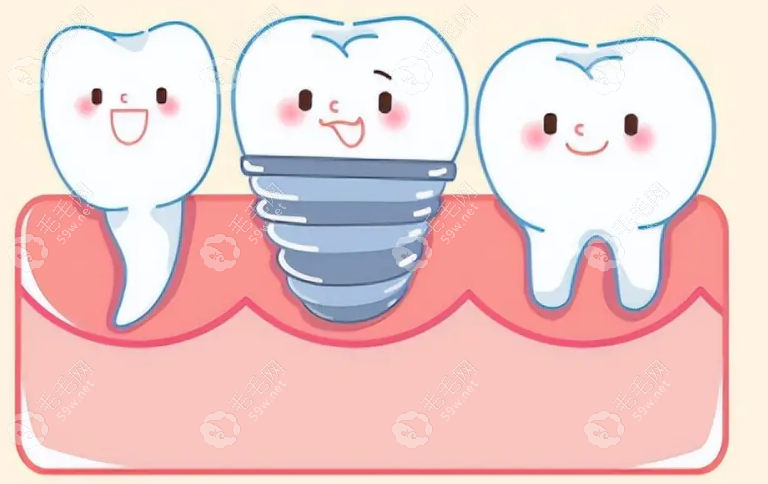 上海雅洁口腔种植牙怎么样