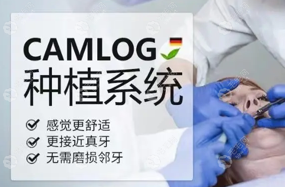 camlog种植体是哪个国家的?德国camlog种植体型号/价格/介绍