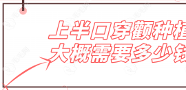 上半口穿颧种植大概需要多少钱?单侧穿颧种植10w+穿颧4颗28w+