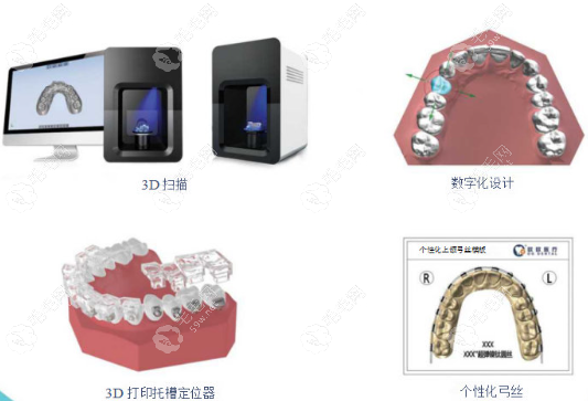 杭州雅莱齿科奥体中心店的技术好