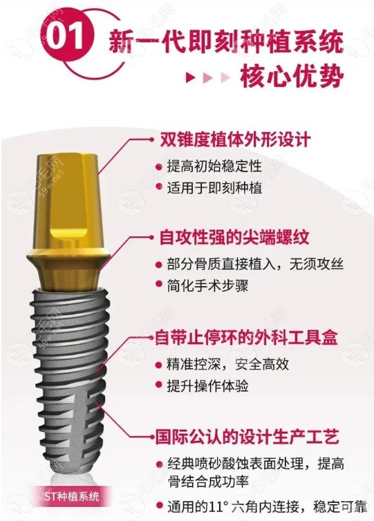 瑞士tplus种植体特点