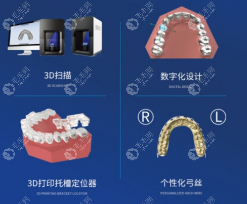 成都茁悦口腔正畸技术好