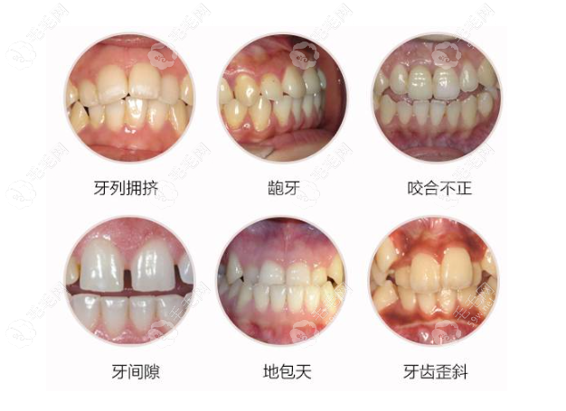 深圳博爱曙光医院矫正牙齿怎么样