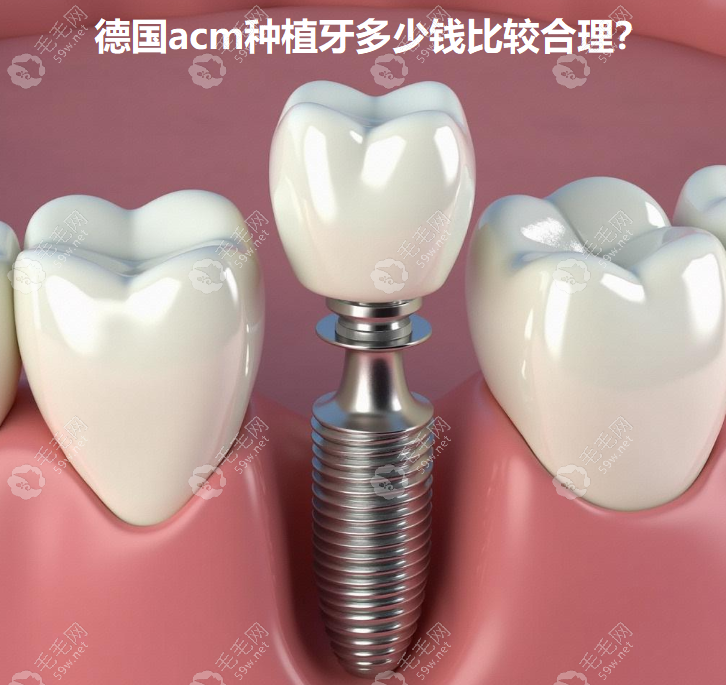 德国acm种植价格多少合理?基本五六千就能种,八九千偏贵了