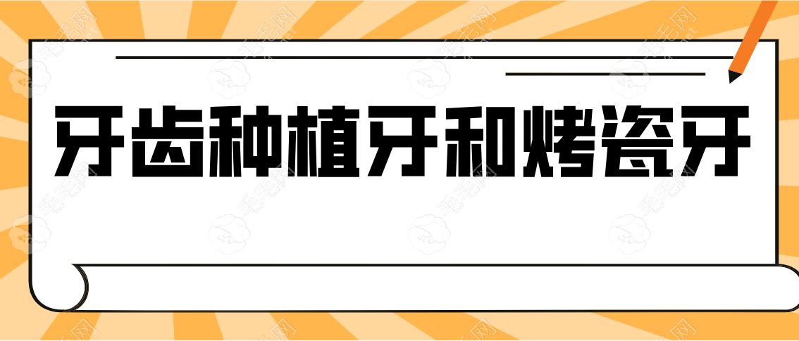 牙齿种植牙好还是烤瓷牙好？烤瓷牙没有种植牙管得久