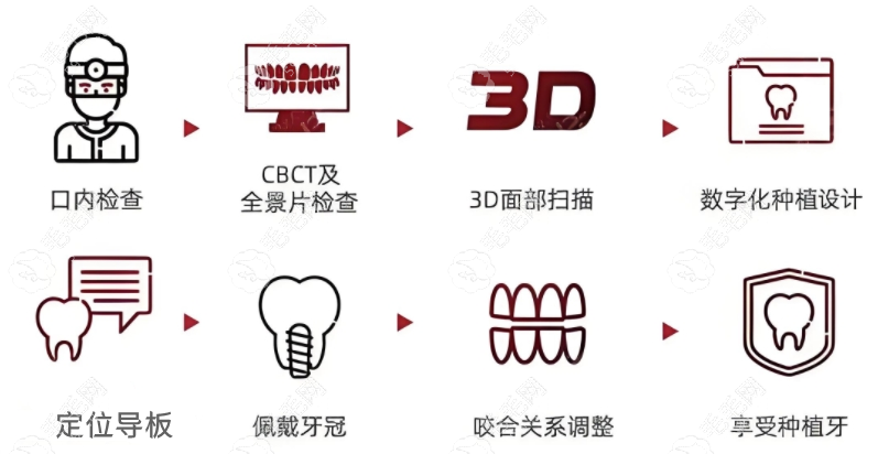 天津做数字化种植牙医院治疗原理