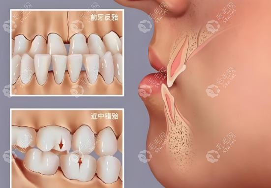 牙齿问题www.59w.net