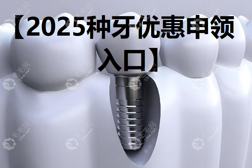 2025种牙优惠申领入口-附近牙科活动查询(含中诺/鼎植/拜博..)