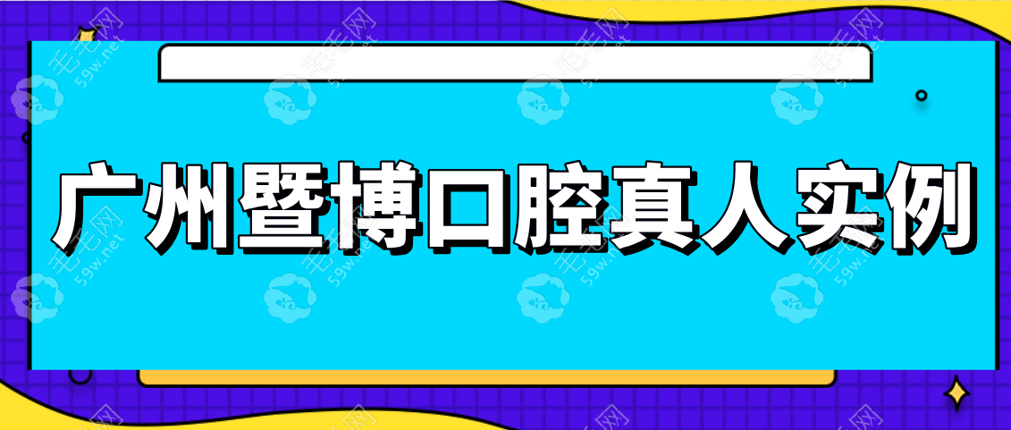 广州暨博口腔真人实例