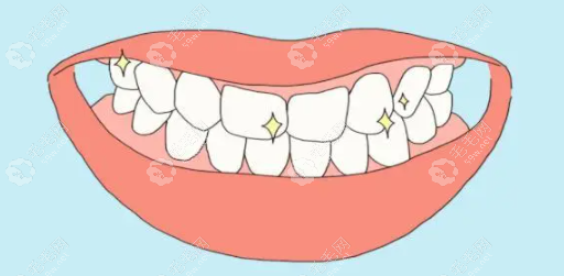 2025杭州烤瓷牙修复好的医院:名一|西湖烤瓷牙修复能保持9年+