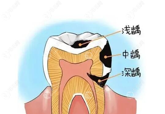 重庆上清寺附近好的口腔推荐:均是渝中区看牙补牙好的牙科