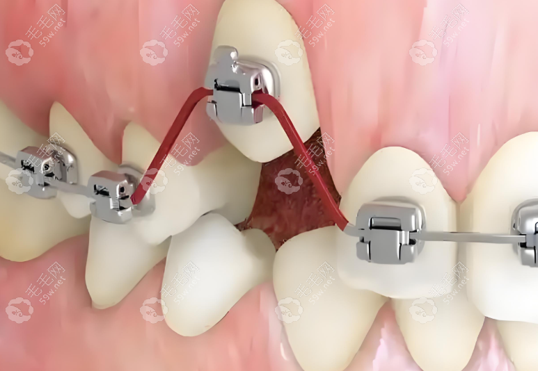 过祯医生口腔诊疗实力强www.59w.net