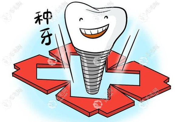 目前衢州種植牙集采收費(fèi)標(biāo)準(zhǔn)