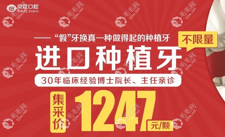 贝臣口腔种植牙集采价