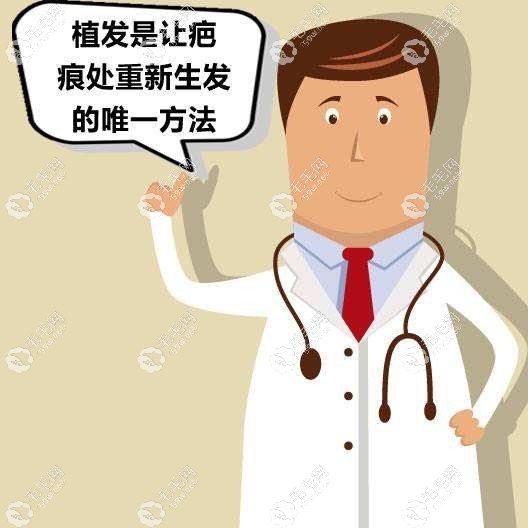 合肥碧莲盛植发医生