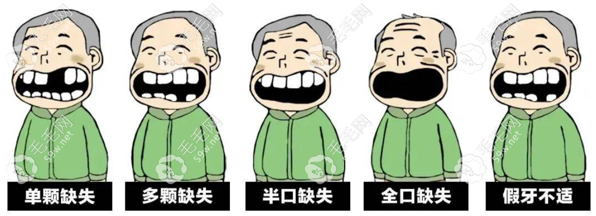 天津口腔医院种植牙人多