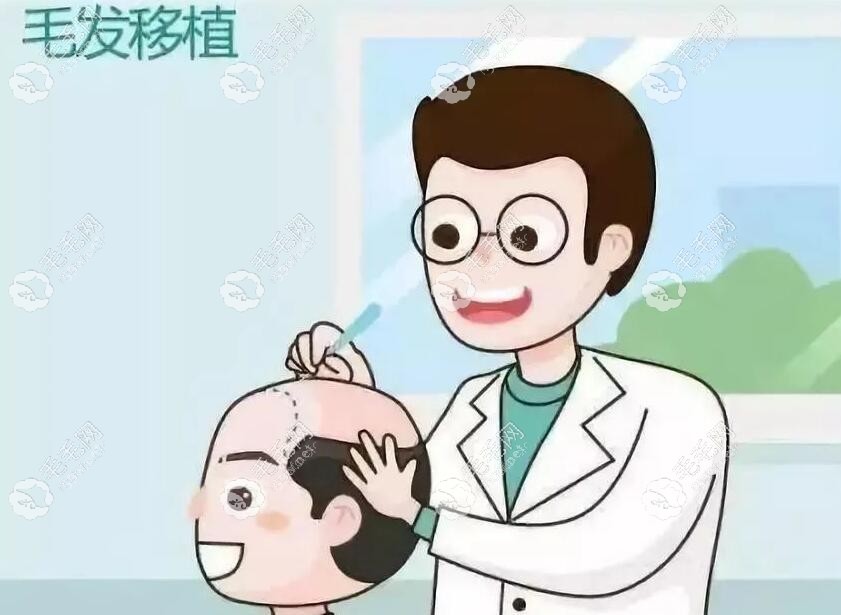 毛发移植动画图