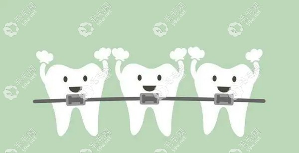 全同步带状弓矫治技术有点贵