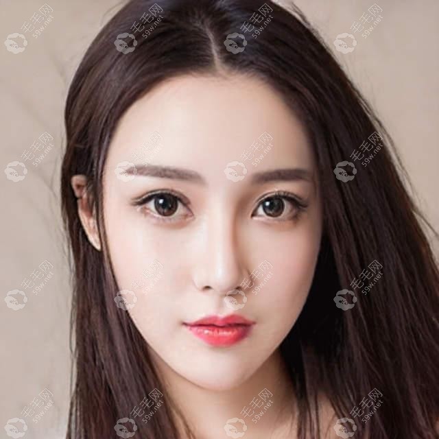 北京美莱fue无痕植发技术的收费情况及董海英植发怎么样?
