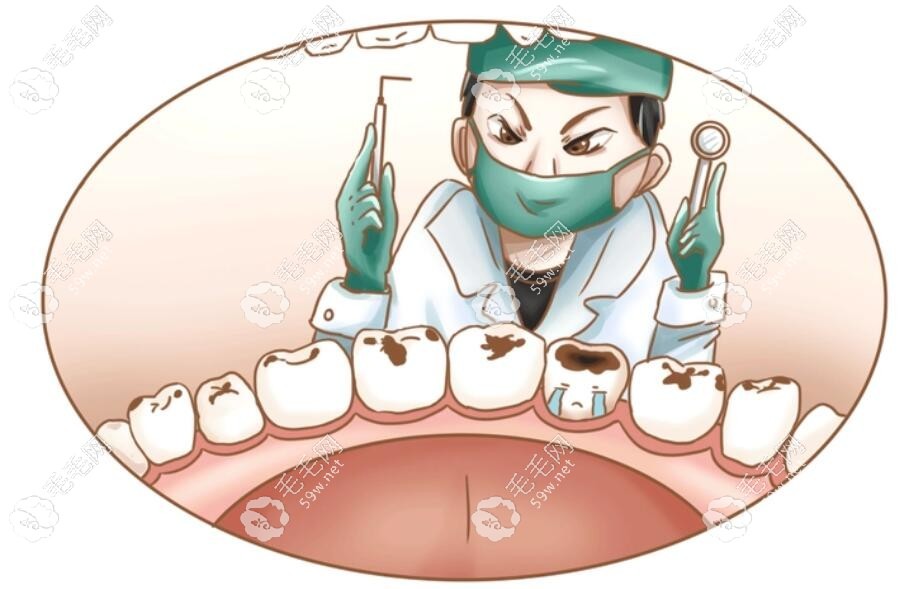 树脂补牙卡通图