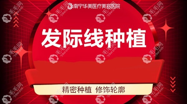 南宁华美发际线种植、头顶加密植发优惠