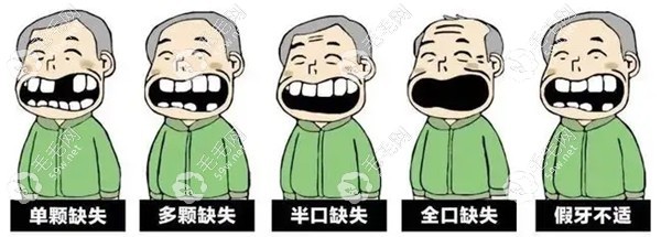 煙臺(tái)種植牙醫(yī)院排名榜
