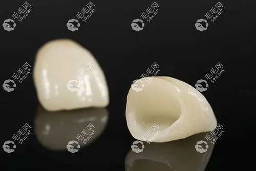 全瓷牙结构示意图www.59w.net