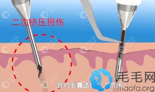 避免了在种植过程中造成二次挤压