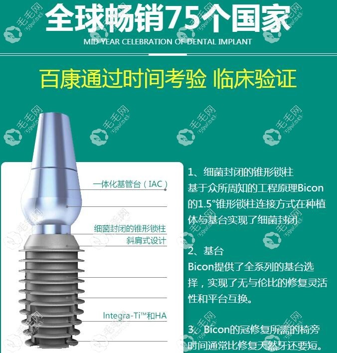 美国百康种植牙的优势点