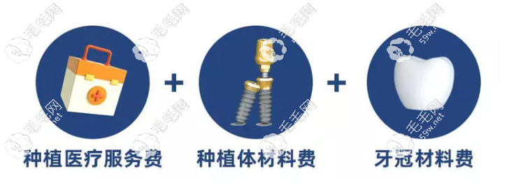 湖州种植牙单颗收费包括牙冠费用与服务费
