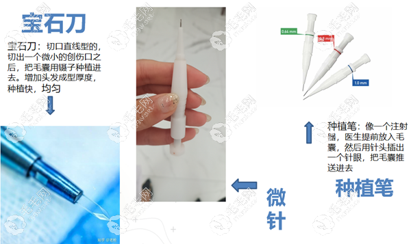 联合种植植发技术各工具