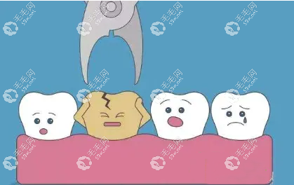 正畸拔4牙的弊端
