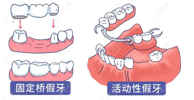 成都中诺口腔种植牙