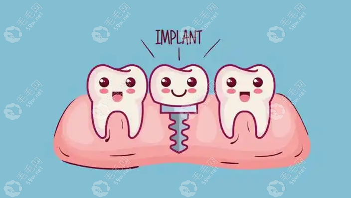 杭州团圆口腔种植牙价格表www.59w.net