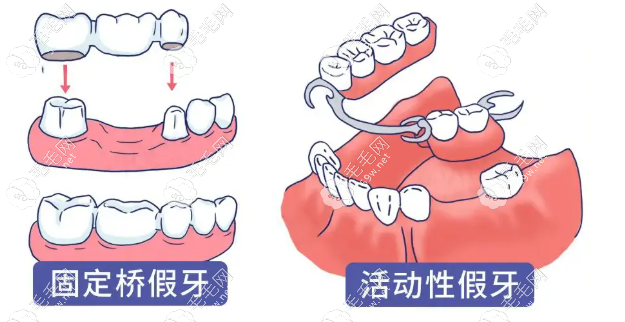 成都中诺口腔种植牙 成都中诺口腔种植牙