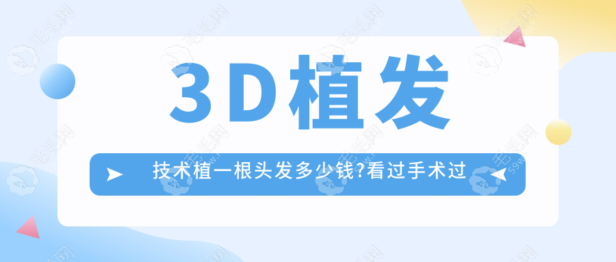 3D植发技术植一根头发多少钱?看过手术过程发现它很值