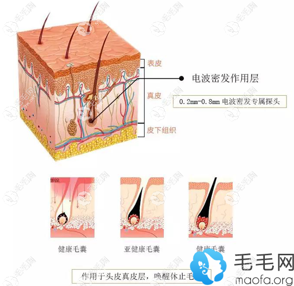 电波密发原理示意图