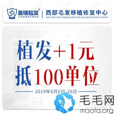 成都首瑞六月植发优惠活动