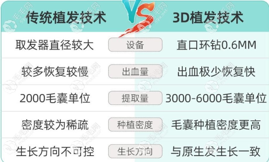 寧波新生3D植發(fā)技術(shù)的優(yōu)勢(shì)