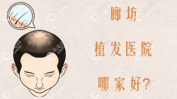 廊坊植发医院哪家好嘞？