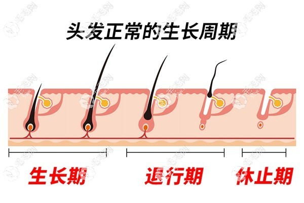 加速毛囊穩(wěn)固小妙招毛毛網(wǎng)