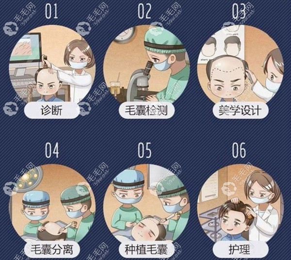 去医院植发的流程