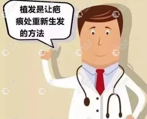 北京碧蓮盛蔣學(xué)醫(yī)生說疤痕植發(fā)