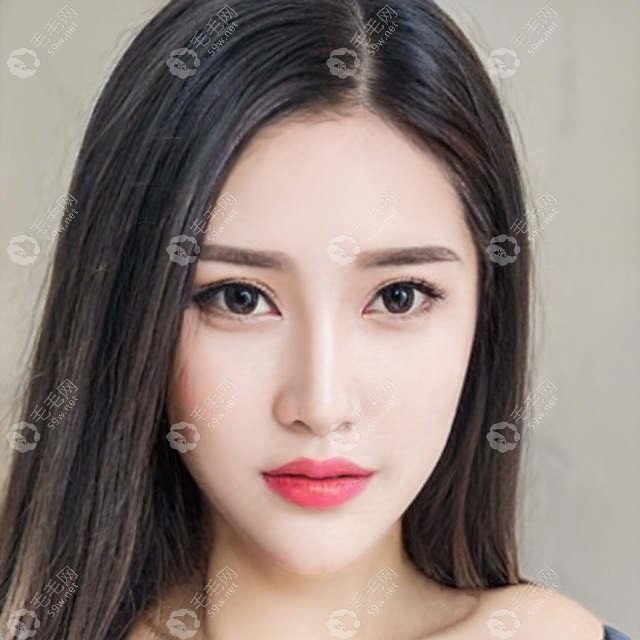 同样的脱发面积,同样的植发单位,效果差别怎么这么大呢