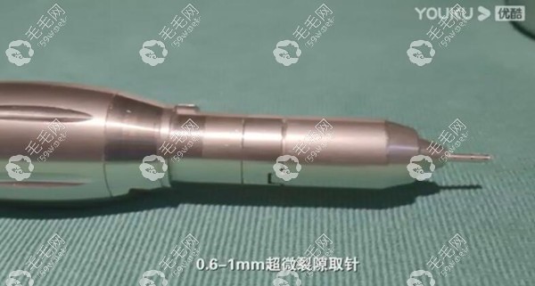 不剃发植发采用的超微裂隙取针