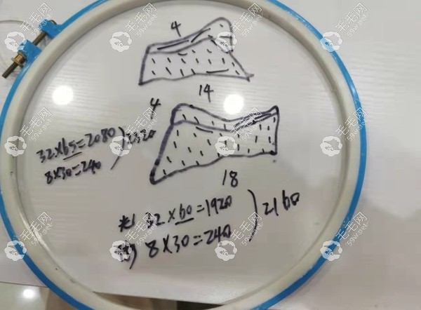 韶关植发价格预估情况