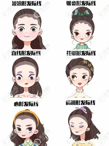 不同发际线种植形状