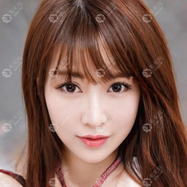 全口种植牙上下6颗共24颗可以吗?可以,比八颗便宜价格在12W起