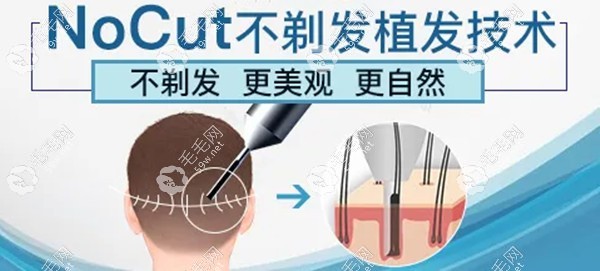 郑州不剃发植发医院哪个好?