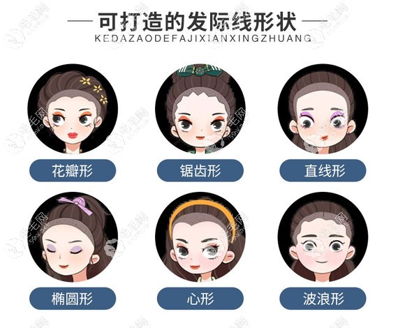 發(fā)際線植發(fā)形狀